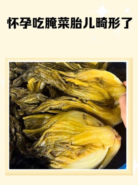 孕妇可以吃酸菜不_怀孕吃酸菜安全吗-第3张图片-星辰妙记
