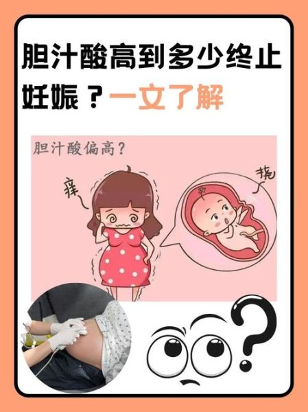 孕妇胆汁酸高有什么症状_胆汁酸偏高对胎儿影响-第2张图片-星辰妙记