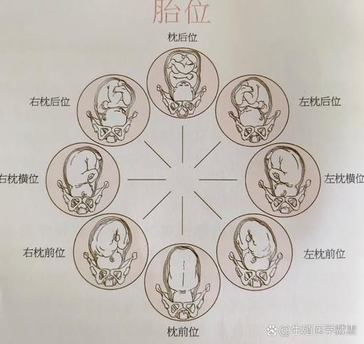 孕妇LOA胎位是什么意思_LOA胎位顺产几率大吗-第1张图片-星辰妙记 孕妇LOA胎位是什么意思_LOA胎位顺产几率大吗-第1张图片-星辰妙记