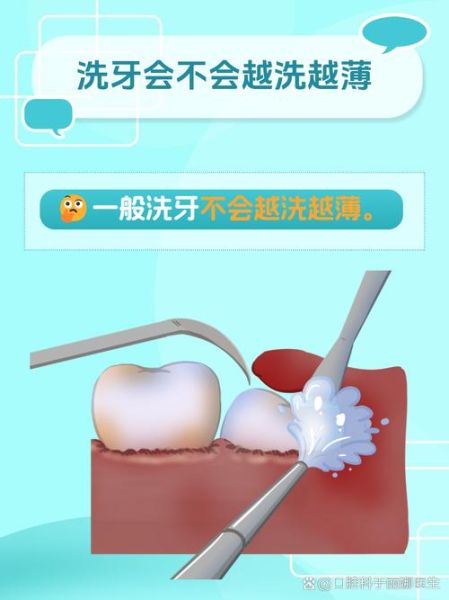 孕妇可以洗牙齿吗_孕期洗牙安全吗-第1张图片-星辰妙记