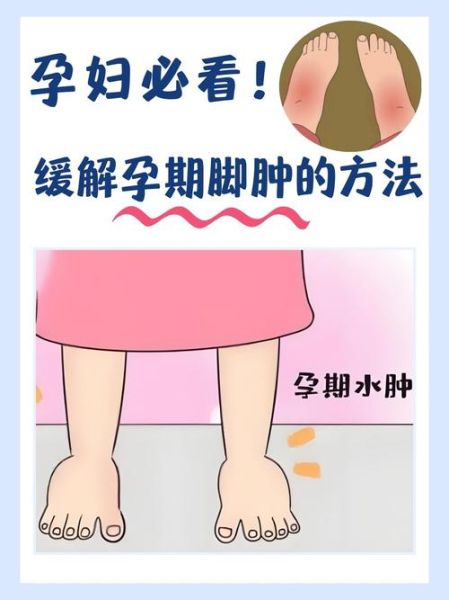 孕妇血糖高脚会肿吗_脚肿与血糖关系-第1张图片-星辰妙记 孕妇血糖高脚会肿吗_脚肿与血糖关系-第1张图片-星辰妙记