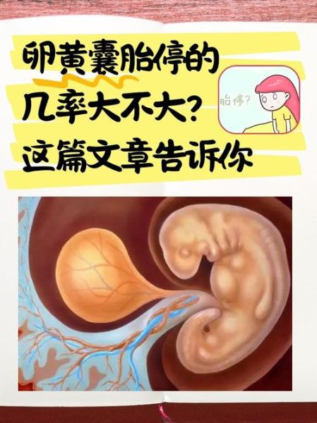 孕妇看黄谍胎儿有记忆吗_会影响宝宝大脑发育吗-第1张图片-星辰妙记