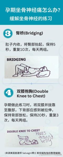 孕妇坐骨神经痛怎么缓解_孕期坐骨神经痛缓解方法-第1张图片-星辰妙记