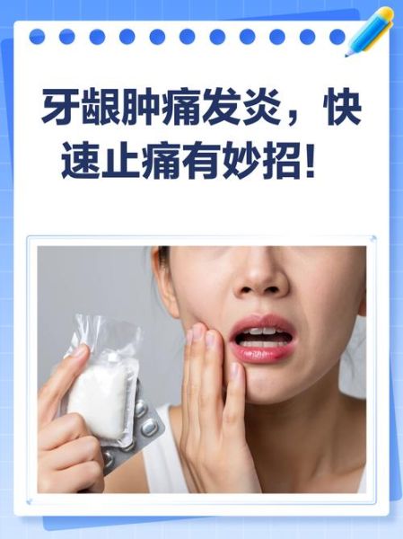孕妇牙龈发炎肿痛怎么办_孕妇牙龈肿痛快速止痛方法-第2张图片-星辰妙记
