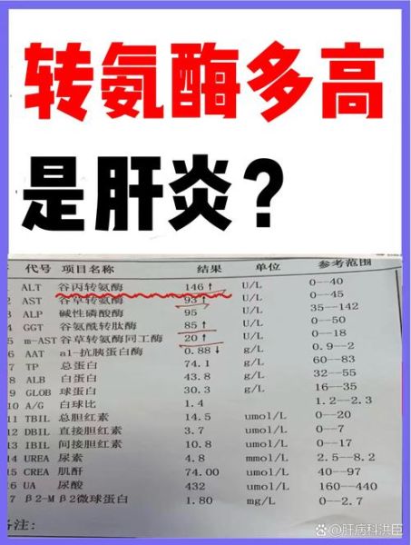 孕妇谷丙转氨酶偏高是什么原因_怎么办-第2张图片-星辰妙记 孕妇谷丙转氨酶偏高是什么原因_怎么办-第2张图片-星辰妙记
