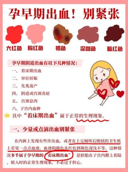 孕妇梦见见红是什么意思_孕妇梦见见红是胎梦吗-第3张图片-星辰妙记 孕妇梦见见红是什么意思_孕妇梦见见红是胎梦吗-第3张图片-星辰妙记