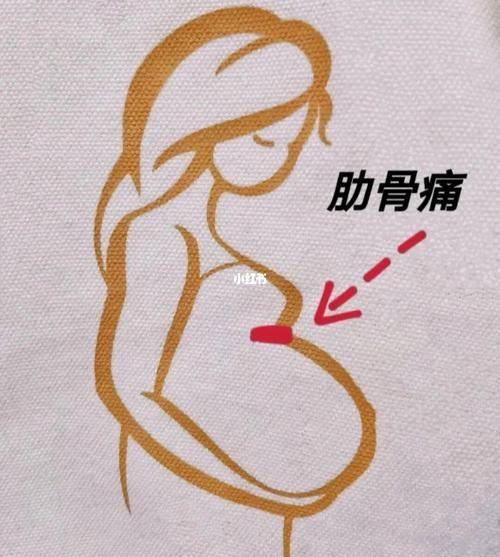 孕妇肋骨疼怎么回事_如何缓解孕晚期肋骨疼-第3张图片-星辰妙记
