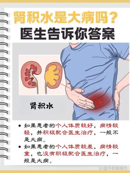 孕妇肾积水是什么原因引起的_孕妇肾积水对胎儿有影响吗-第1张图片-星辰妙记