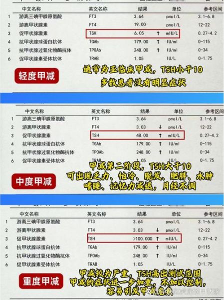 孕妇tsh正常值范围_孕期甲减怎么办-第2张图片-星辰妙记
