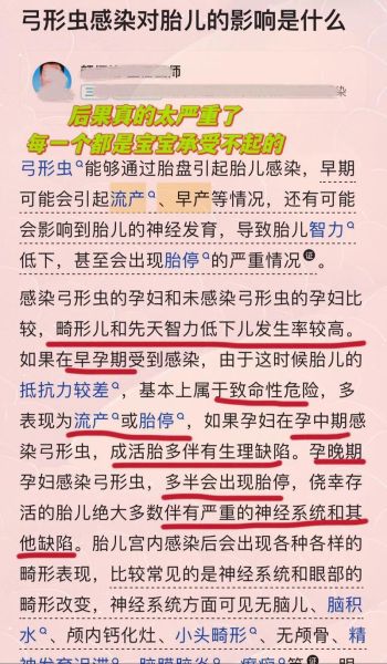 孕妇养猫对胎儿的危害_弓形虫感染风险有多大-第2张图片-星辰妙记