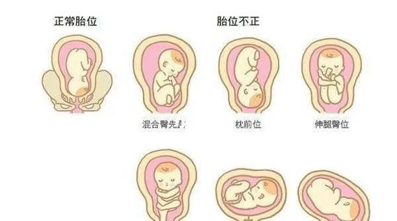 孕妇肚子歪向一边正常吗_孕妇肚子歪是什么原因-第1张图片-星辰妙记