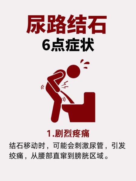 孕妇尿路结石怎么办_孕妇肾结石疼痛缓解方法-第2张图片-星辰妙记