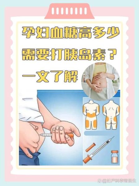 孕妇打胰岛素对胎儿有影响吗_孕期胰岛素安全吗-第1张图片-星辰妙记