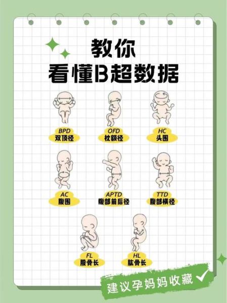 孕妇做b超需要憋尿吗_孕早期b超注意事项-第1张图片-星辰妙记