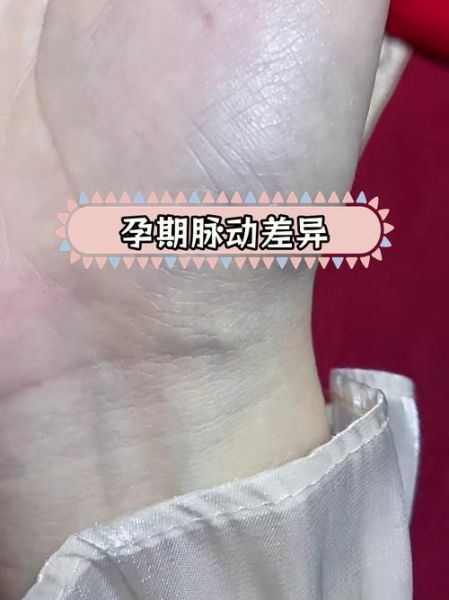 孕妇脉搏多少正常_孕早期孕晚期心率变化-第2张图片-星辰妙记