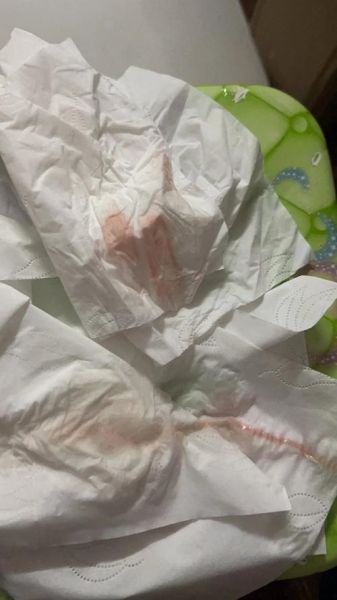 孕妇梦见自己内裤见红_梦见见红是胎梦吗-第2张图片-星辰妙记