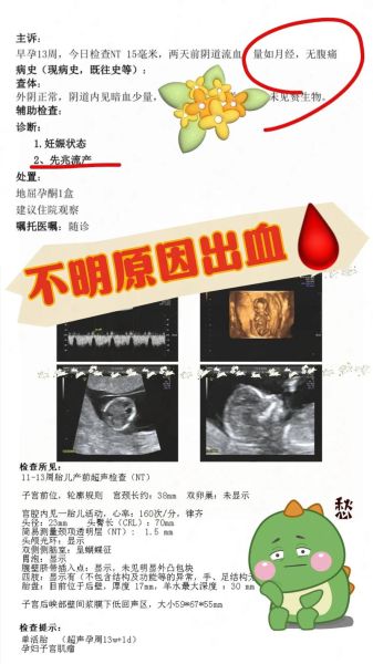 孕妇七个月出血是怎么回事_七个月出血怎么办-第3张图片-星辰妙记 孕妇七个月出血是怎么回事_七个月出血怎么办-第3张图片-星辰妙记