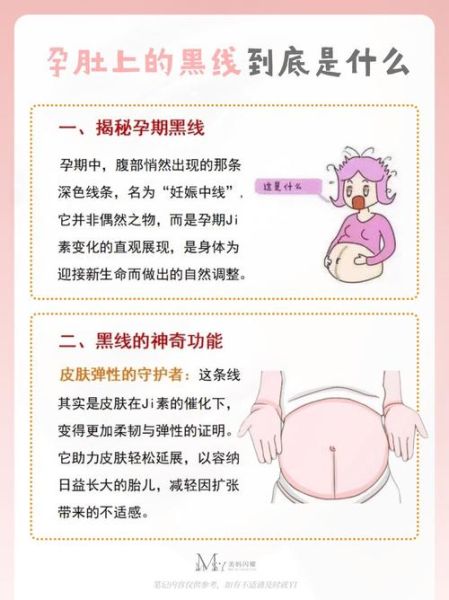 孕妇拉黑便是怎么回事_孕妇拉黑便正常吗-第2张图片-星辰妙记