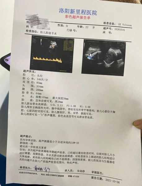 孕妇sd值是什么意思_孕妇sd值偏高怎么办-第1张图片-星辰妙记