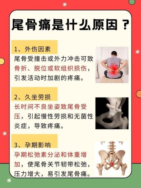 孕妇尾巴骨疼什么原因_如何缓解-第1张图片-星辰妙记 孕妇尾巴骨疼什么原因_如何缓解-第1张图片-星辰妙记