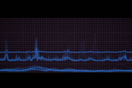 孕妇可以做动态心电图吗_对胎儿有没有影响-第1张图片-星辰妙记 孕妇可以做动态心电图吗_对胎儿有没有影响-第1张图片-星辰妙记