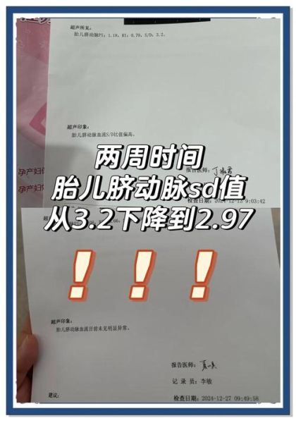 孕妇sd值正常范围_孕妇sd值偏高怎么办-第1张图片-星辰妙记 孕妇sd值正常范围_孕妇sd值偏高怎么办-第1张图片-星辰妙记