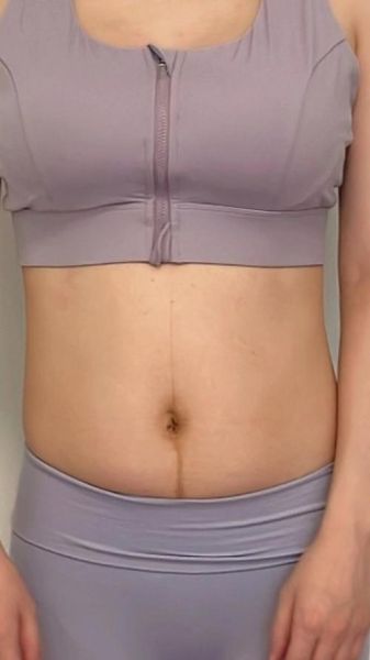 孕妇肚子上长毛正常吗_怎么去除-第3张图片-星辰妙记