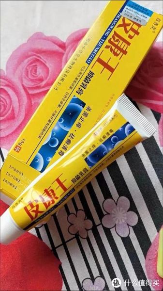 孕妇皮肤瘙痒擦什么药_孕期止痒安全用药指南-第2张图片-星辰妙记